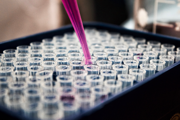 In einem Gefäß stehen mehrere Reagenzgläser mit flüssigen Laborproben. Aus einer Probe wird die Flüssigkeit mithilfe einer Pipette aufgezogen.